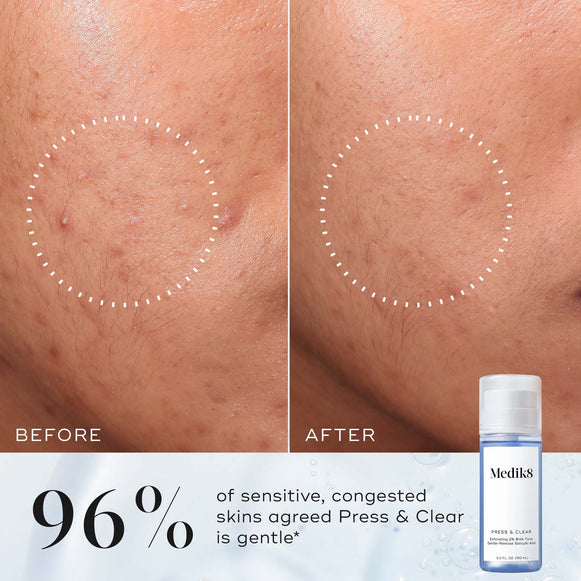 Press & Clear hover
