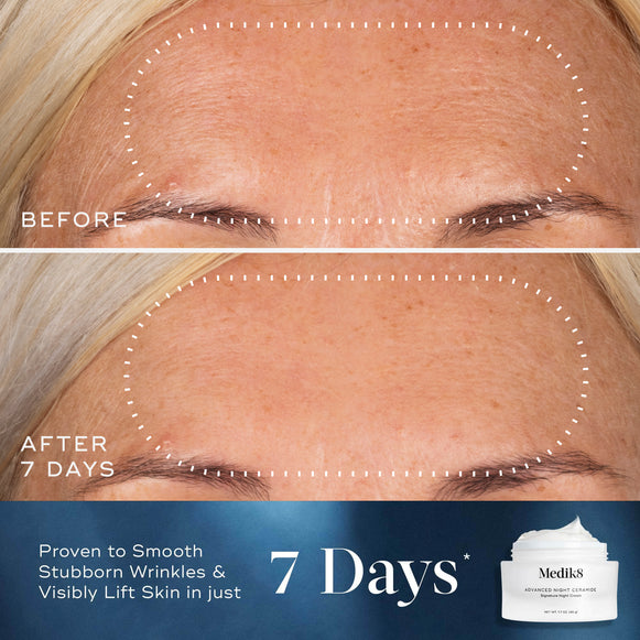 Advanced Night Ceramide-hover-6
