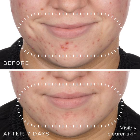 Niacinamide Peptides-hover-1