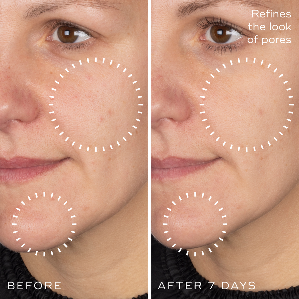 Niacinamide Peptides