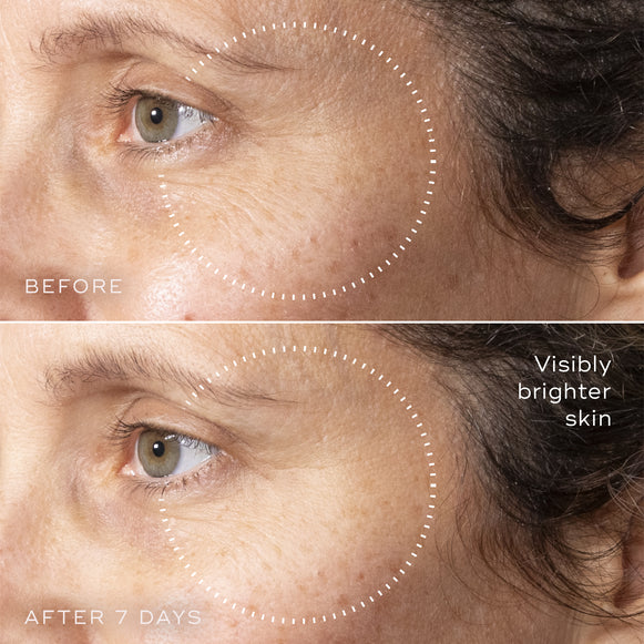 C-Tetra™ Advanced Gel-Serum-hover-7