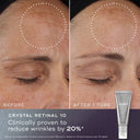 Reduce, Renew, Retinal