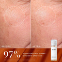 Luminous Lift Kit