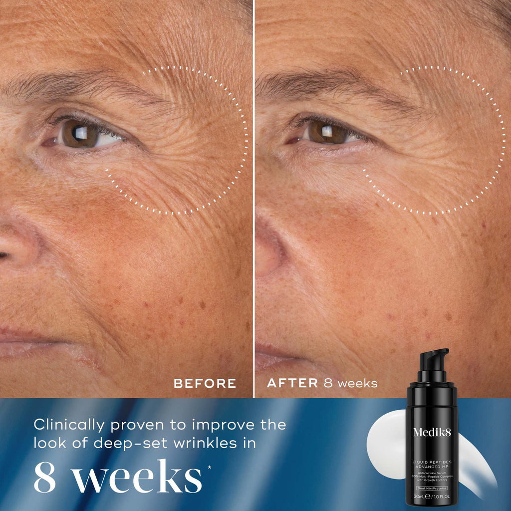 Peptide Precision Kit