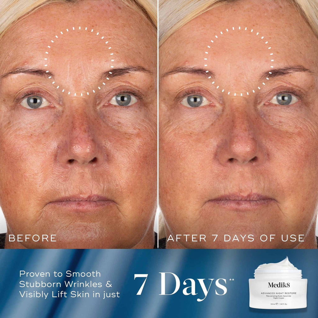 Peptide Precision Kit
