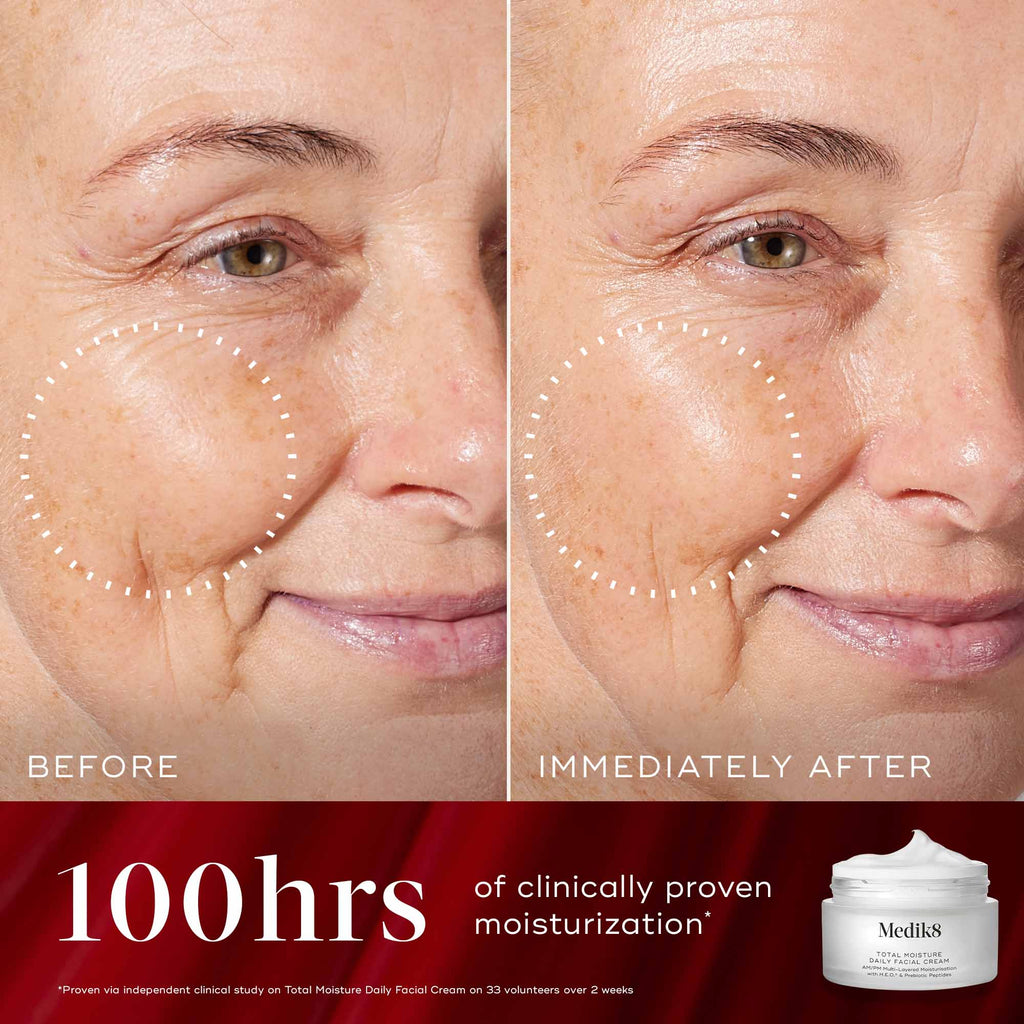 Radiance Wrapped Kit
