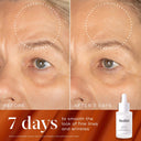 Luminous Lift Kit