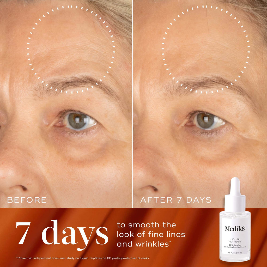 Luminous Lift Kit