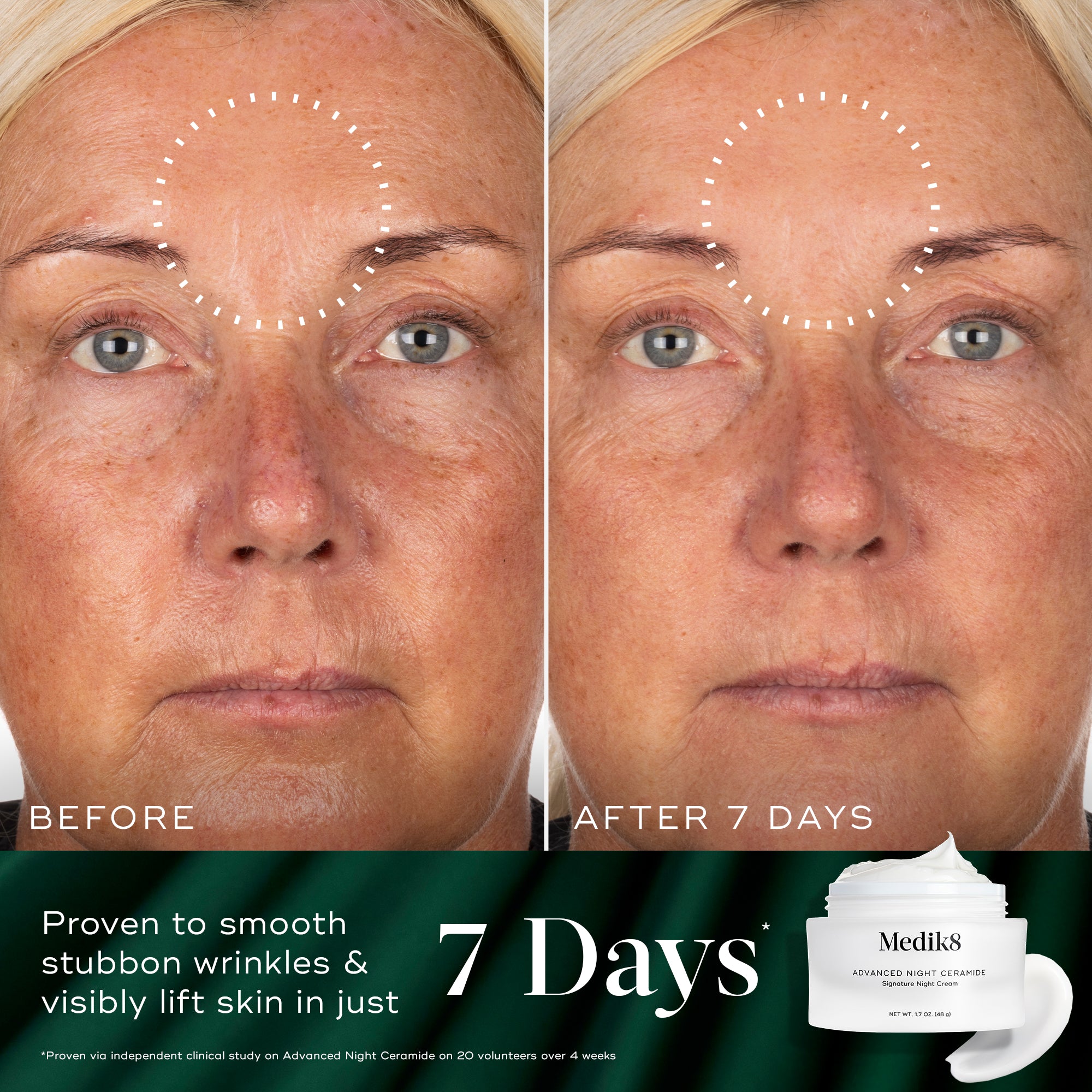 EXONINE DERMACODE ナイト＆モーニングクリームセット At Ebony Cosmetics and Hair Lounge, we're excited to introduce our