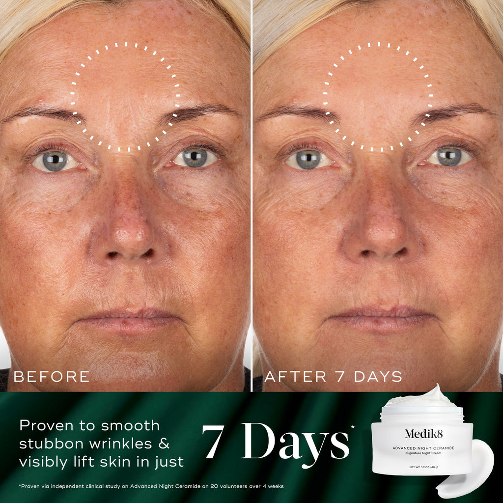 Overnight Renewal Kit