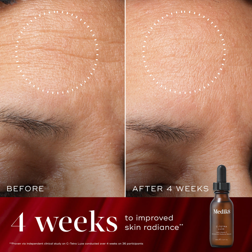 Radiance Wrapped Kit