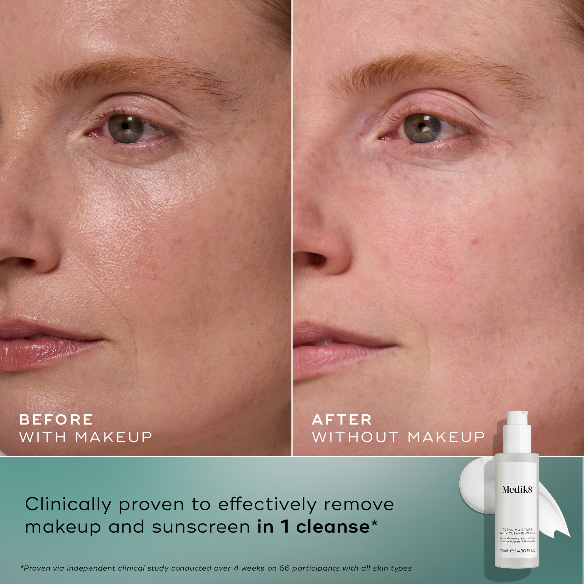 Total Moisture Daily Cleansing Gel